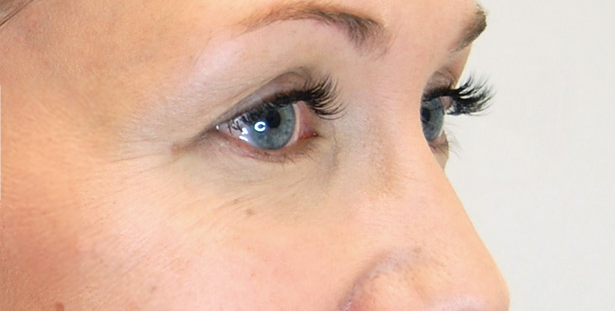 Ripset pidennysten jälkeen